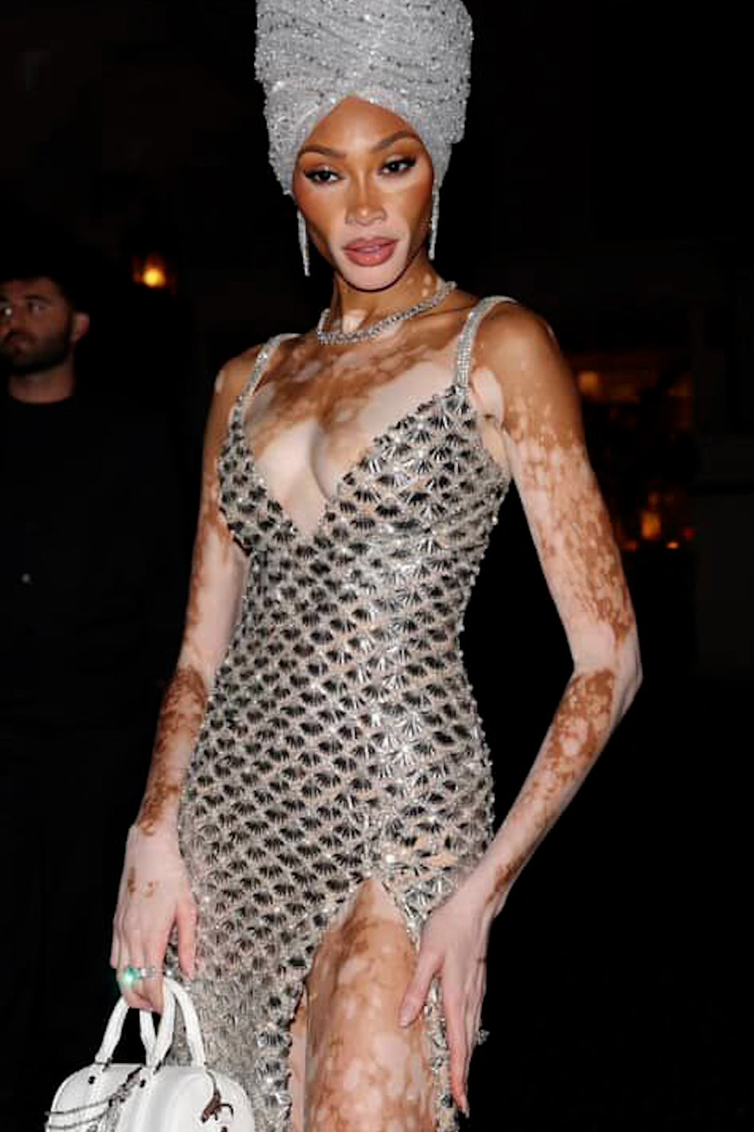 Winnie Harlow
